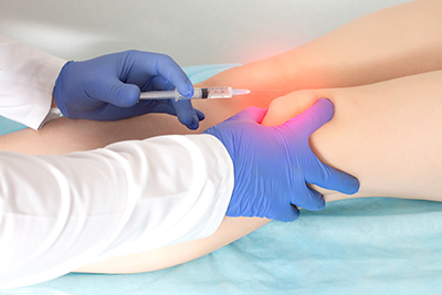 How PRP Therapy is Revolutionizing Sports Injury Treatment | Center for Sports and Regenerative Orthopedics