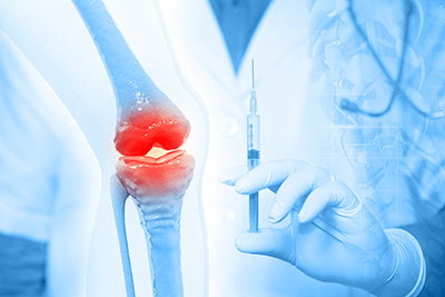Regenerative Medicine | Center for Sports and Regenerative Orthopedics