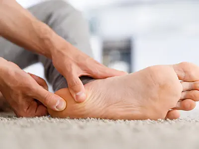 Plantar Fasciitis in Runners